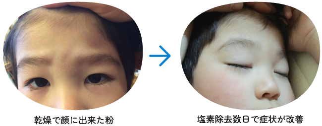 乾燥肌が治った